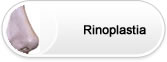 bt-rinoplastia1
