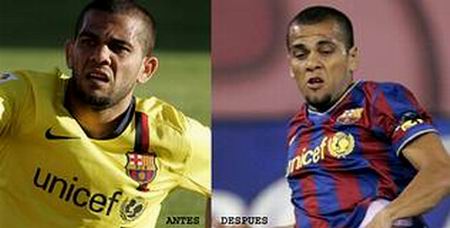 dani-alves-operacion-otoplastia
